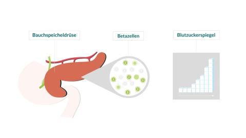 Video: Autoimmunerkrankung - Das Beispiel Typ-1-Diabetes