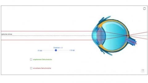 Interaktion: Das Auge mit Brille