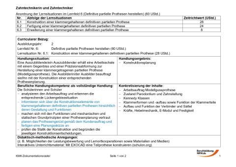 Unterrichtsplanung: Konstruktion einer klammergehaltenen definitiven partiellen Prothese